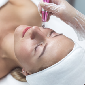 Bono 3 sesiones Dermapen NCTF Vitam