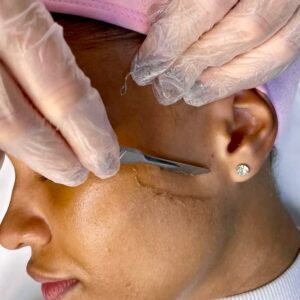 Dermaplaning