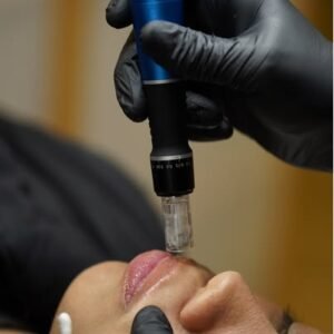 Hidratación de labios con dermapen