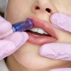 Bono 3 sesiones hidratación de labios (dermapen )